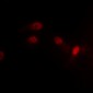 Anti-MDM2 (pS186/S188) Antibody